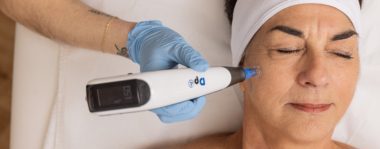 Microneedling DP4 : améliorez la texture de votre peau