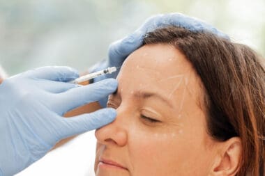 Neuromodulateurs : atténuez les rides d’expression