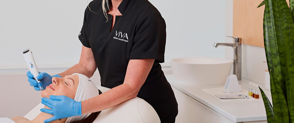 Microneedling DP4 : améliorez la texture de votre peau