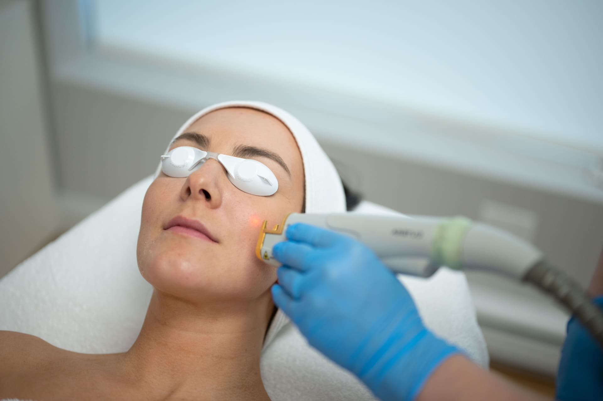 Laser vasculaire : enlevez varicosités et points de rubis