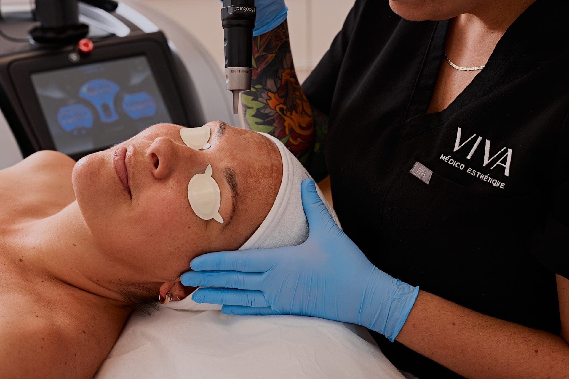 Laser Picosure Pro : enlevez le mélasma efficacement