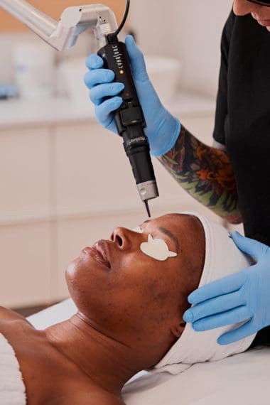 Laser pigmentaire Picosure Pro : clarifiez votre teint