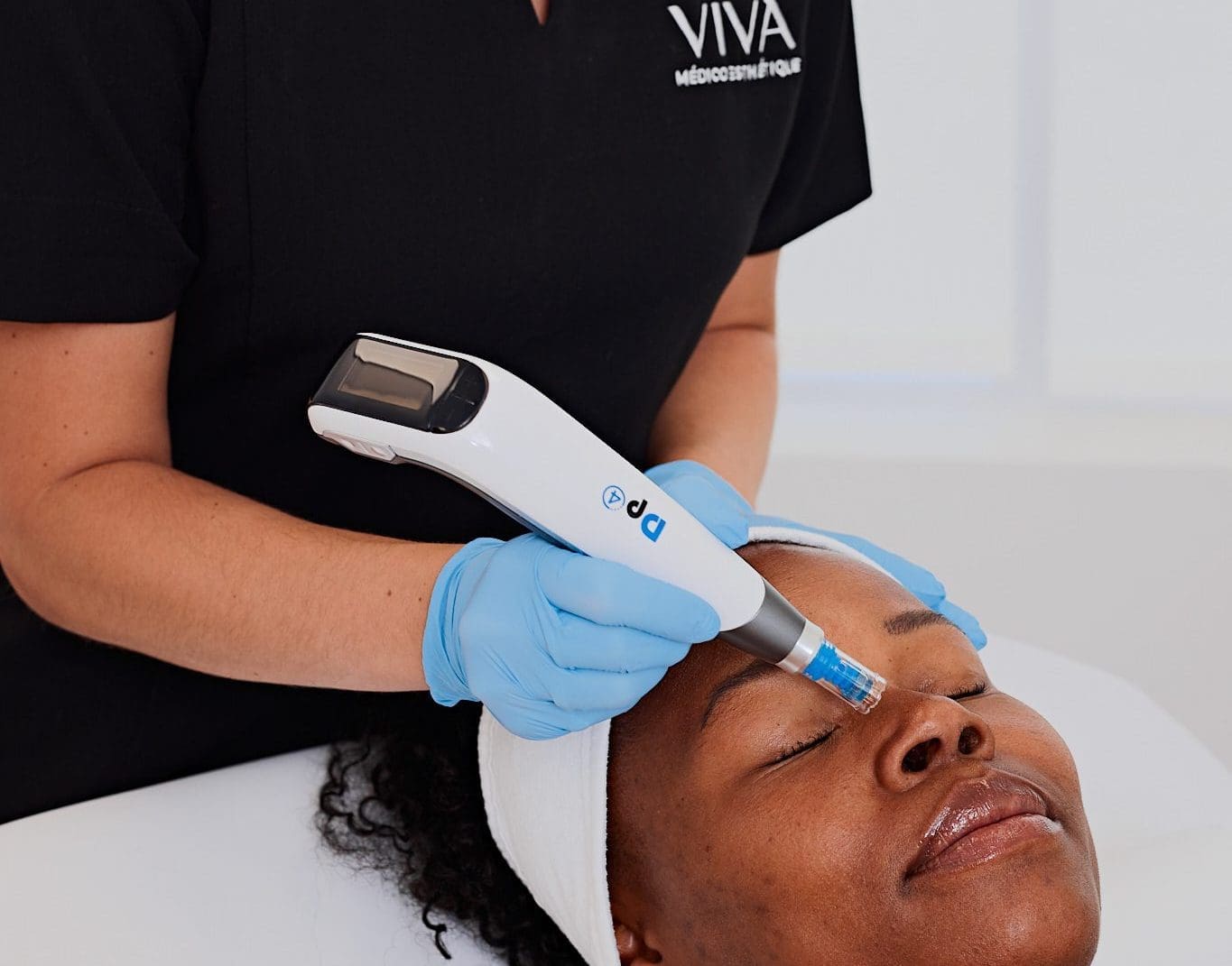 Une personne portant des gants bleus utilise un appareil de microneedling sur le front d'une autre personne lors d'un soin à la Clinique médico-esthétique Viva. La cliente, les yeux fermés et coiffée d'un bandeau blanc, est allongée sur la table de soins.
