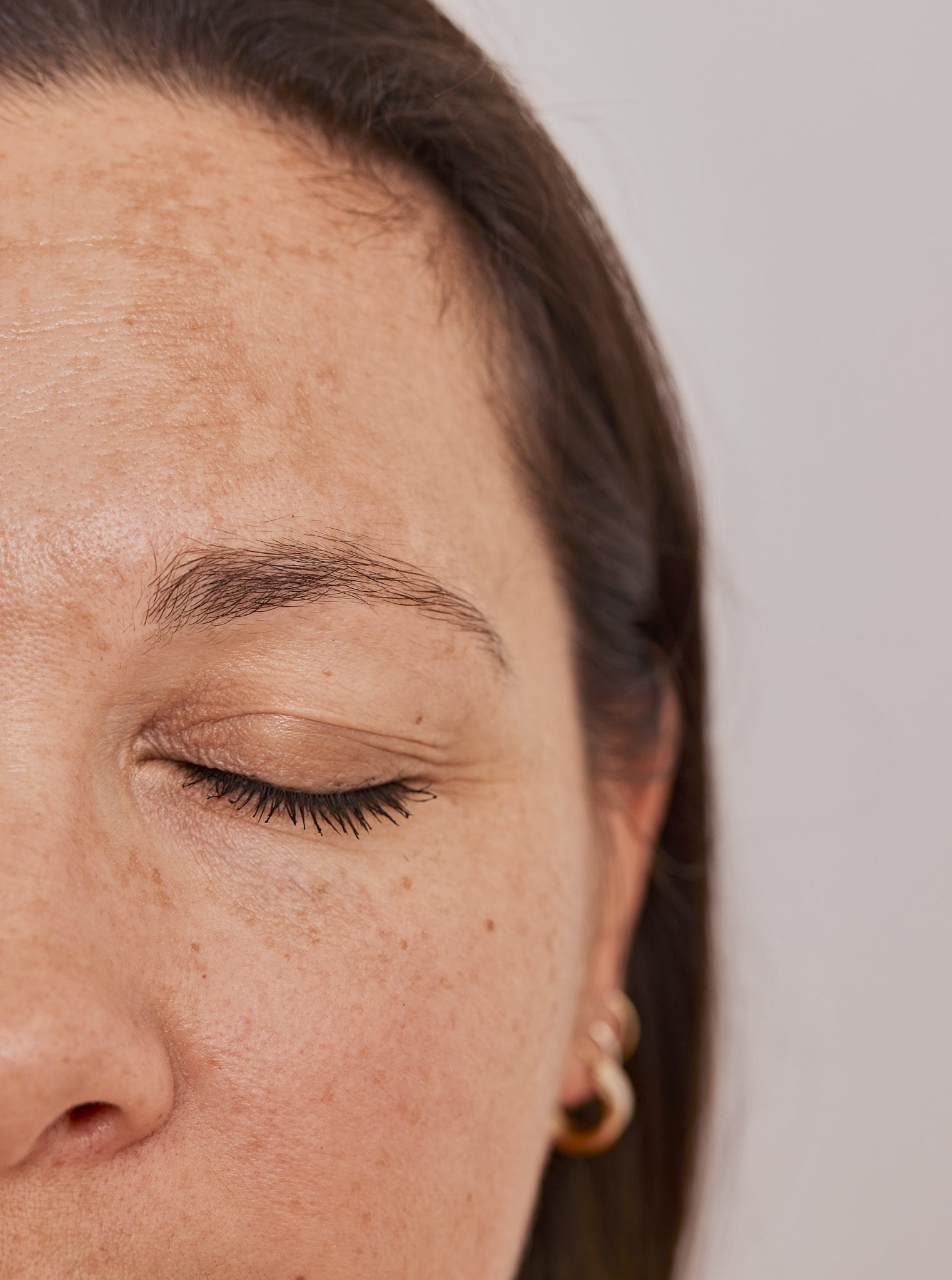 Gros plan du visage d'une femme, les yeux fermés, révélant une texture de peau naturelle, des taches de rousseur et une hyperpigmentation. Elle a les cheveux foncés, la peau châtain clair et porte une petite boucle d'oreille en or, reflet de la beauté naturelle célébrée à la Clinique médico-esthétique Viva.