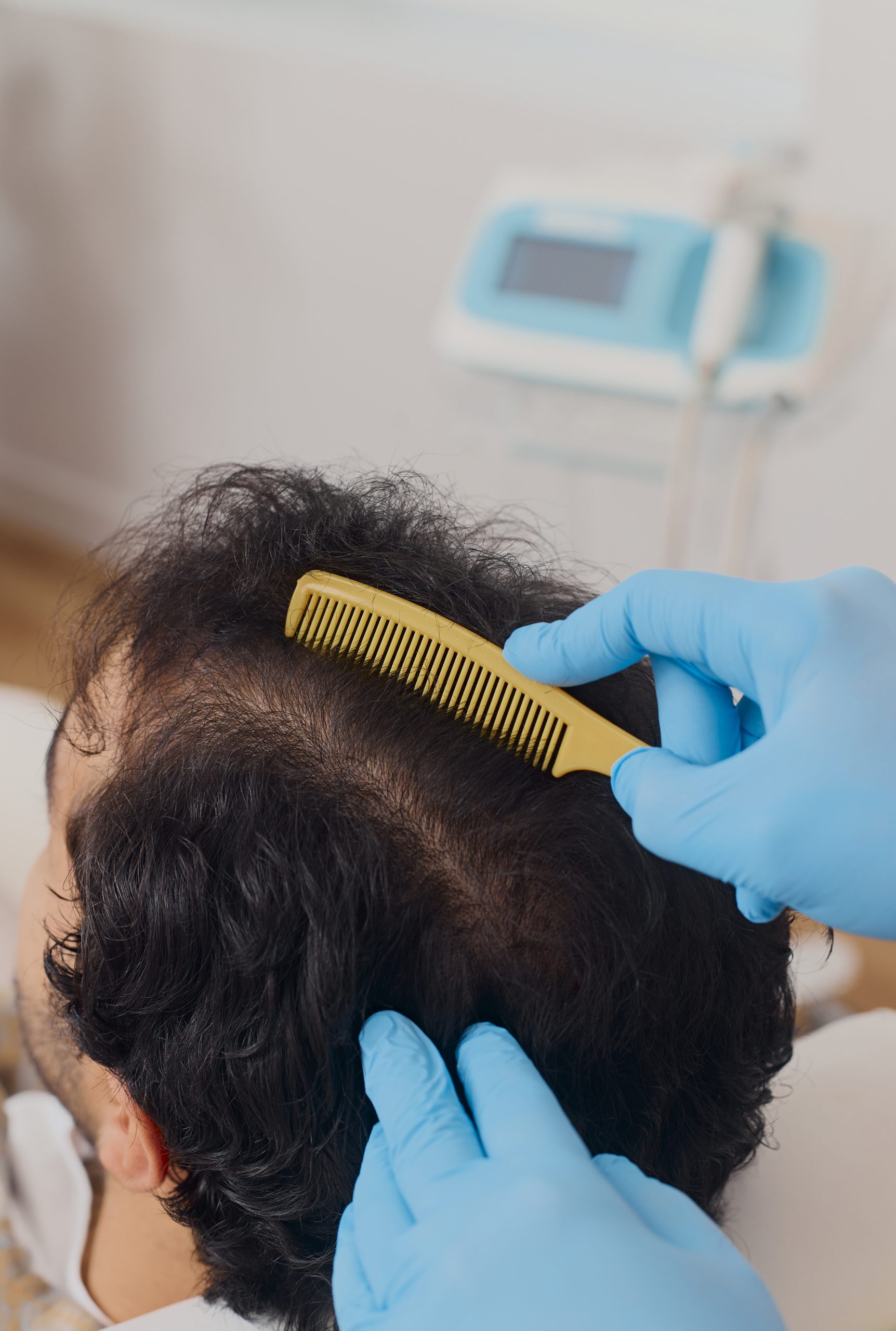 Une personne aux cheveux foncés est assise tandis qu'une personne portant des gants bleus lui sépare les cheveux avec un peigne jaune, possiblement pour un examen du cuir chevelu aux Cliniques Viva Québec. Un appareil médical est visible en arrière-plan.