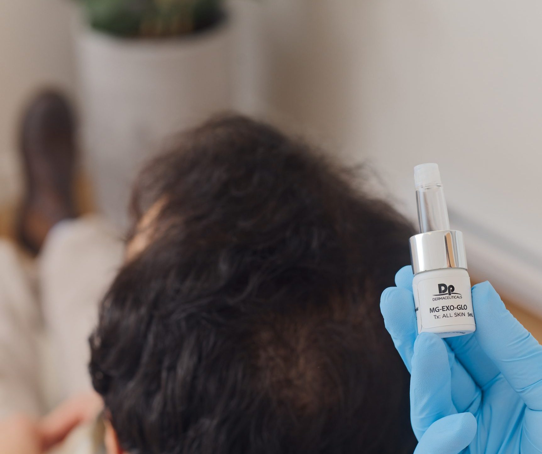 Une main gantée tient une petite bouteille étiquetée Dp. MG-EXO-GLO près de la tête d'une personne aux cheveux clairsemés, suggérant un traitement des cheveux ou du cuir chevelu à la Clinique médico-esthétique Viva.