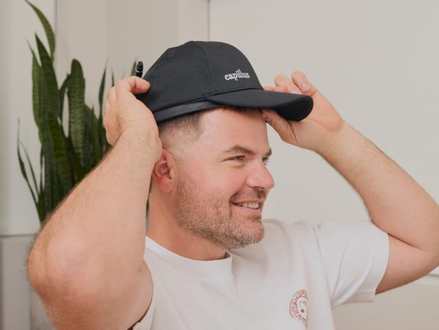 Solution perte de cheveux : les traitements offerts aux Cliniques VIVA