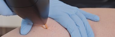 Vasculaze