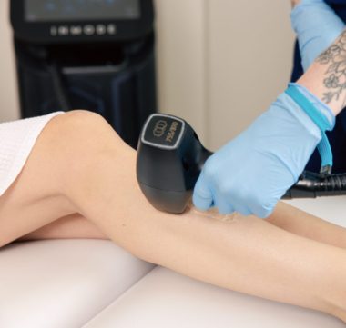 Laser Triton – Demi jambe + Aisselles